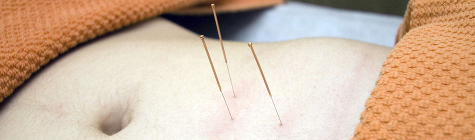 Accupuncture, Eastern Healing Arts in the Bensalem, Bucks County PA area